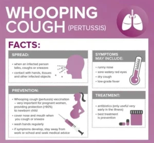 Whooping Cough (1)