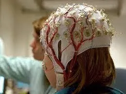 Electroencephalogram (EEG)