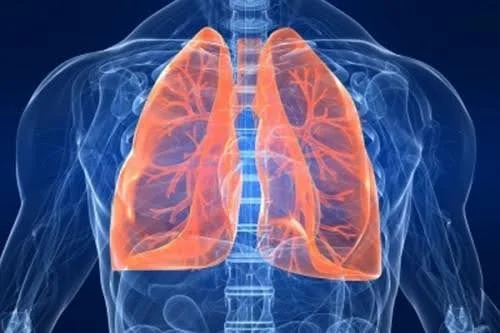 Chronic Pulmonary Aspergillosis (CPA)