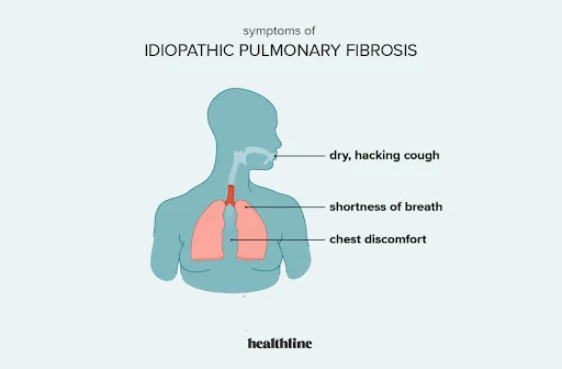 Idiopathic Pulmonary Fibrosis (IPF)